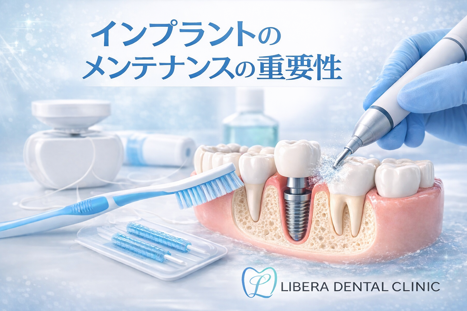 インプラントのメンテナンスはなぜ重要?長持ちさせるためのポイントを解説|横浜市南区井土ヶ谷の歯科 リベラデンタルクリニック